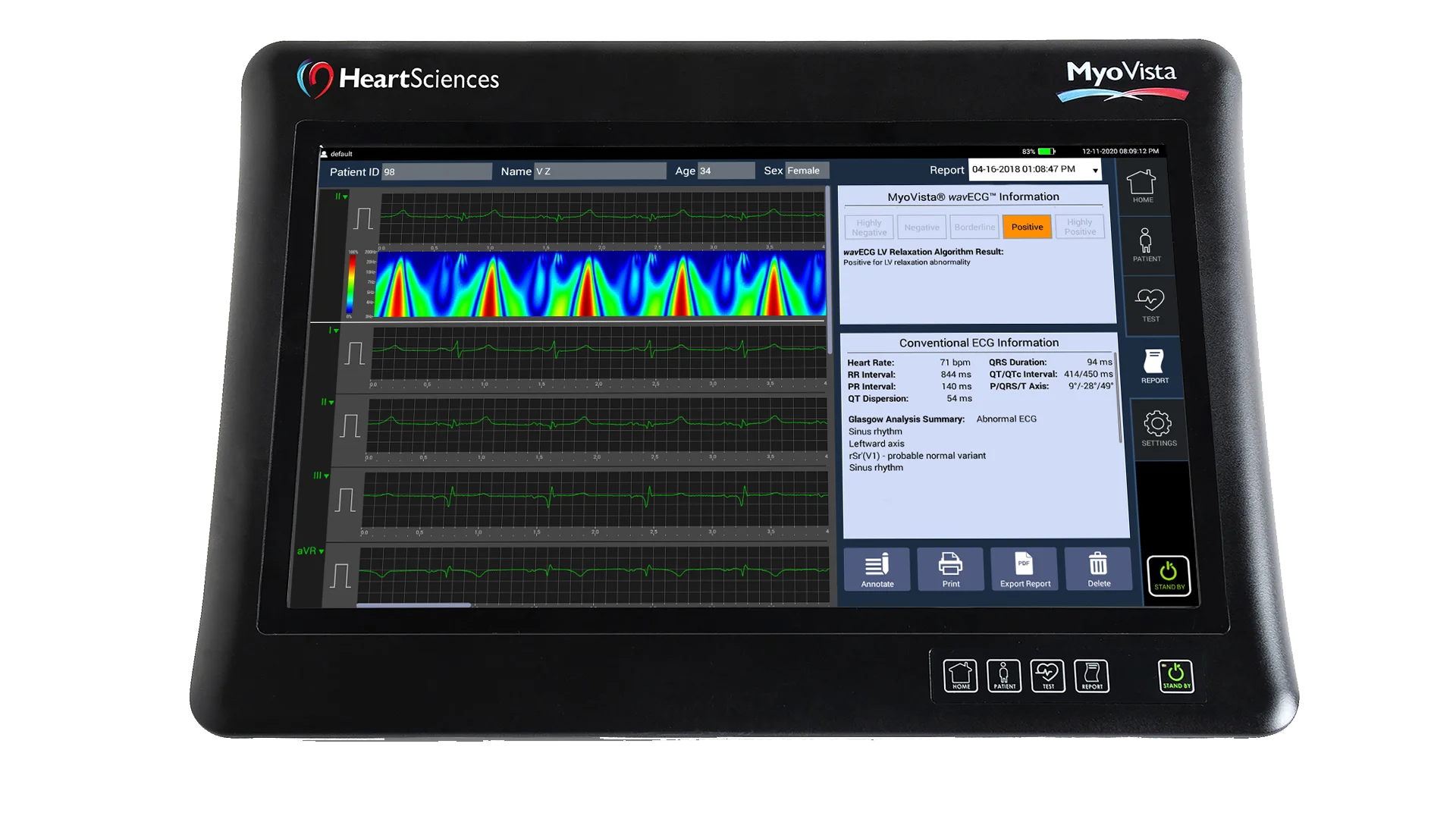 MyoVista wavECG Device - Clinical-Grade ECG Acquisition